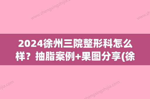 2024徐州三院整形科怎么样？抽脂案例+果图分享(徐州三院整形科是私人的吗)