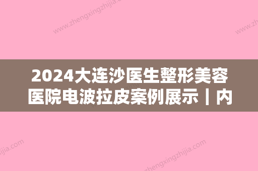 2024大连沙医生整形美容医院电波拉皮案例展示｜内含真人果图