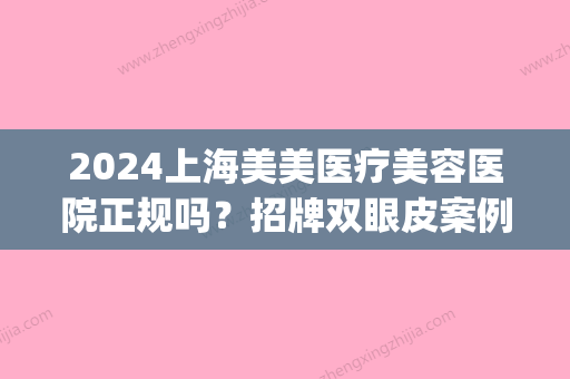 2024上海美美医疗美容医院正规吗？招牌双眼皮案例展示(上海美美医疗整形医院)