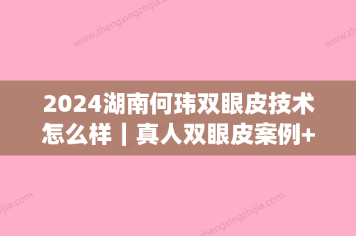 2024湖南何玮双眼皮技术怎么样｜真人双眼皮案例+果图展示(长沙何玮双眼皮)