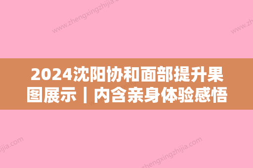 2024沈阳协和面部提升果图展示｜内含亲身体验感悟