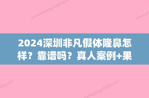 2024深圳非凡假体隆鼻怎样？靠谱吗？真人案例+果图公布(做假体隆鼻是永久的吗)