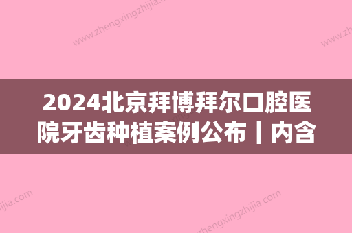 2024北京拜博拜尔口腔医院牙齿种植案例公布｜内含体验果图(拜博口腔规模)