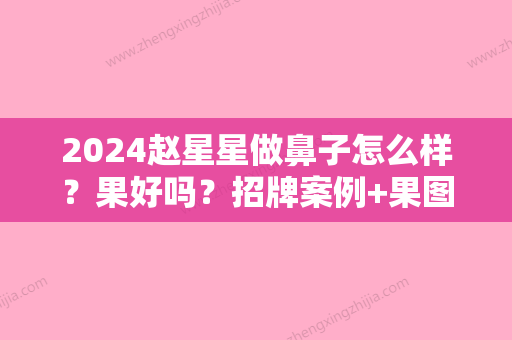 2024赵星星做鼻子怎么样？果好吗？招牌案例+果图分享