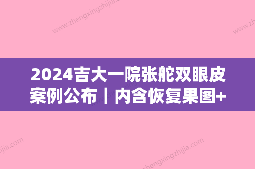 2024吉大一院张舵双眼皮案例公布｜内含恢复果图+价格表(吉林大学第一医院张舵做双眼皮多少钱)