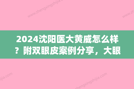 2024沈阳医大黄威怎么样？附双眼皮案例分享，大眼睛的秘诀(沈阳黄威双眼皮照片)