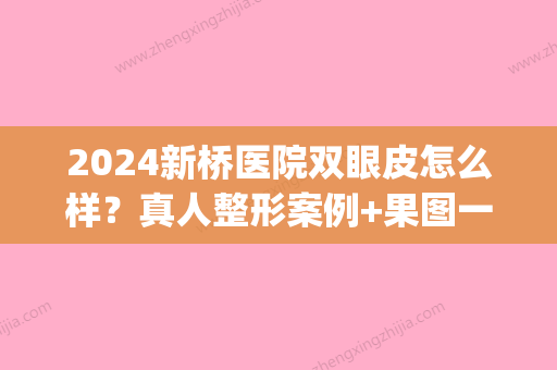 2024新桥医院双眼皮怎么样？真人整形案例+果图一览(新桥医院整形外科)