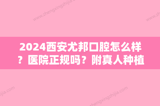 2024西安尤邦口腔怎么样？医院正规吗？附真人种植牙果图