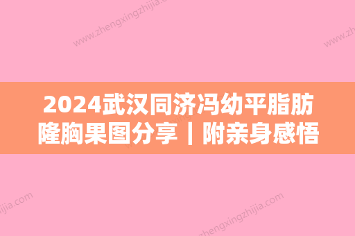 2024武汉同济冯幼平脂肪隆胸果图分享｜附亲身感悟