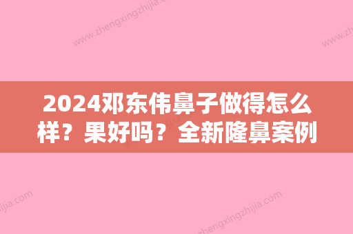 2024邓东伟鼻子做得怎么样？果好吗？全新隆鼻案例曝光