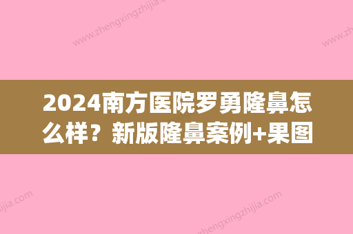 2024南方医院罗勇隆鼻怎么样？新版隆鼻案例+果图曝光(广州南方医院 罗勇 双眼皮)