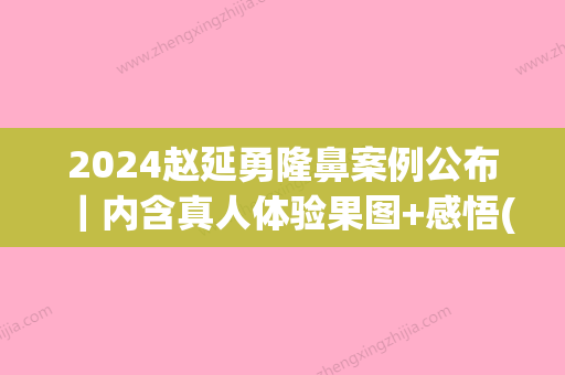 2024赵延勇隆鼻案例公布｜内含真人体验果图+感悟(赵延勇做鼻子多少钱)