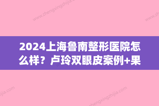 2024上海鲁南整形医院怎么样？卢玲双眼皮案例+果图展示(上海鲁南卢玲眼综合怎么样)