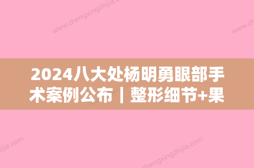 2024八大处杨明勇眼部手术案例公布｜整形细节+果图一览