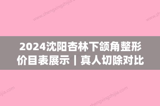 2024沈阳杏林下颌角整形价目表展示｜真人切除对比图展示(沈阳杏林整形医院报价)