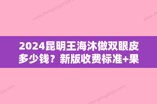 2024昆明王海沐做双眼皮多少钱？新版收费标准+果图分享