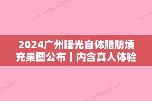 2024广州曙光自体脂肪填充果图公布｜内含真人体验感悟