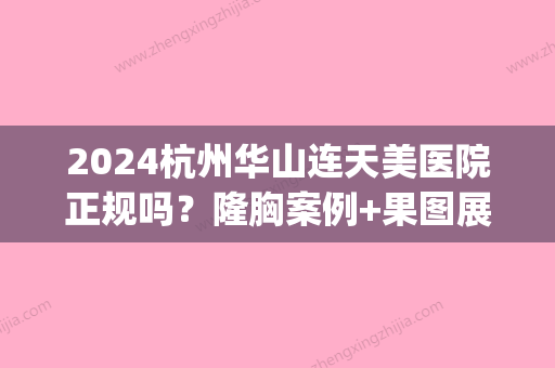 2024杭州华山连天美医院正规吗？隆胸案例+果图展示(杭州华山连天美医疗美容医院正规吗)