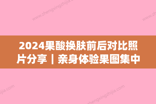 2024果酸换肤前后对比照片分享｜亲身体验果图集中一览(果酸换肤图片 前后)