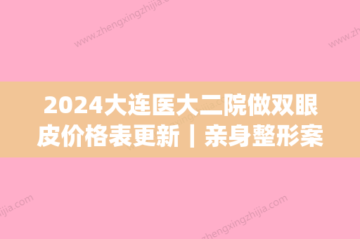 2024大连医大二院做双眼皮价格表更新｜亲身整形案例+细节分享(大连医大二院双眼皮多少钱)