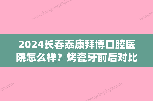 2024长春泰康拜博口腔医院怎么样？烤瓷牙前后对比果图分享(大连泰康拜博口腔医院怎么样)