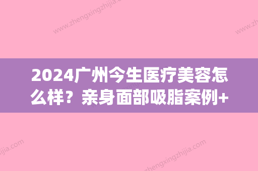 2024广州今生医疗美容怎么样？亲身面部吸脂案例+果图分享(广州今生医疗整形医院)