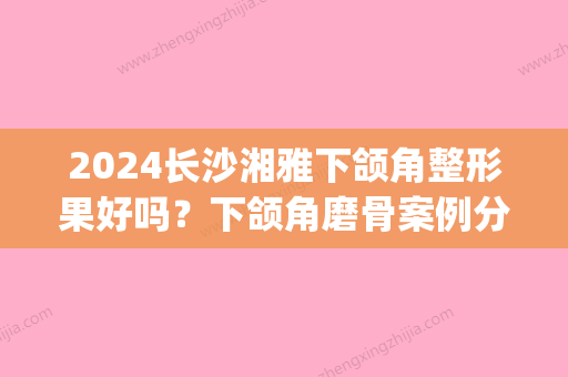 2024长沙湘雅下颌角整形果好吗？下颌角磨骨案例分享(湘雅医院下颌角手术多少钱)