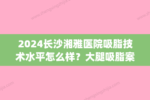 2024长沙湘雅医院吸脂技术水平怎么样？大腿吸脂案例~(长沙湘雅医院抽脂)