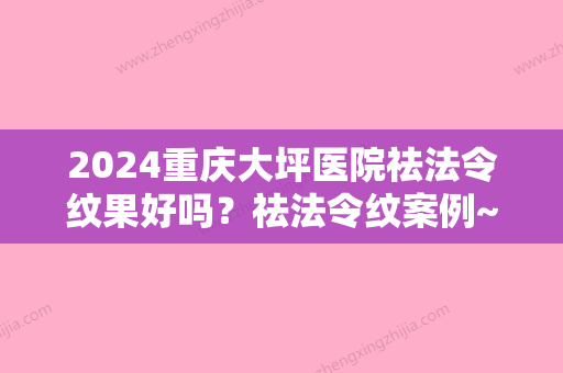 2024重庆大坪医院祛法令纹果好吗？祛法令纹案例~