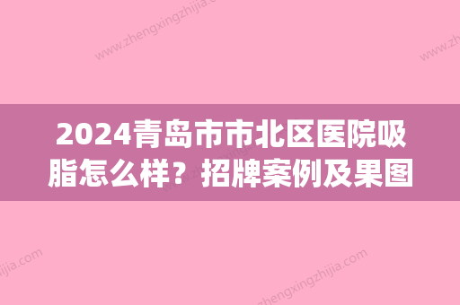 2024青岛市市北区医院吸脂怎么样？招牌案例及果图一览~(青岛吸脂多少钱)