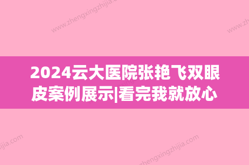 2024云大医院张艳飞双眼皮案例展示|看完我就放心了