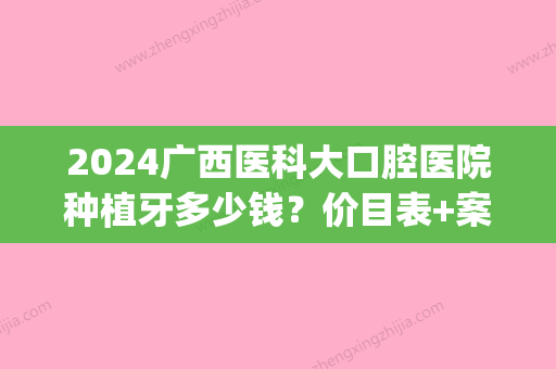 2024广西医科大口腔医院种植牙多少钱？价目表+案例公布(广西医科大种牙多少钱一颗)