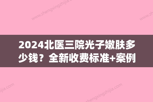 2024北医三院光子嫩肤多少钱？全新收费标准+案例公布(北京三甲医院光子嫩肤多少钱)