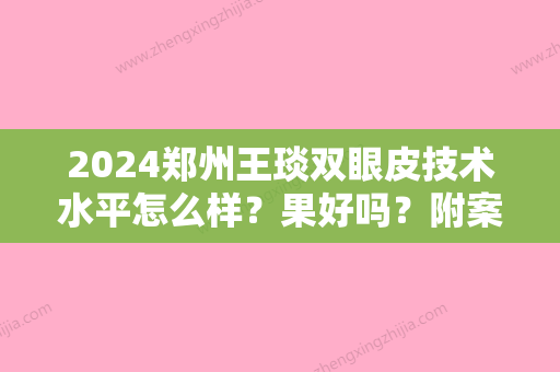 2024郑州王琰双眼皮技术水平怎么样？果好吗？附案例