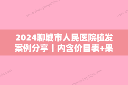 2024聊城市人民医院植发案例分享｜内含价目表+果图