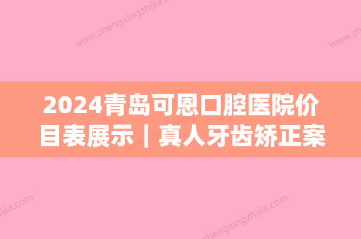 2024青岛可恩口腔医院价目表展示｜真人牙齿矫正案例曝光(青岛可恩牙科医院)