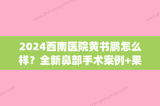 2024西南医院黄书鹏怎么样？全新鼻部手术案例+果图分享~(西南医院黄书鹏疤痕价格)