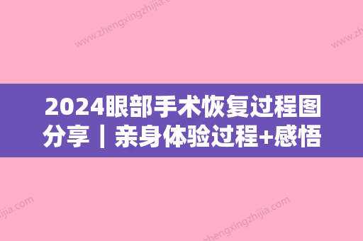 2024眼部手术恢复过程图分享｜亲身体验过程+感悟分享~