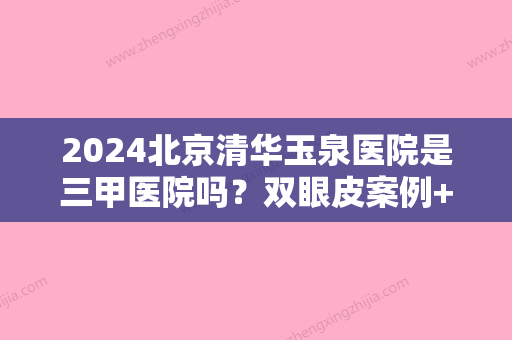 2024北京清华玉泉医院是三甲医院吗？双眼皮案例+果图一览