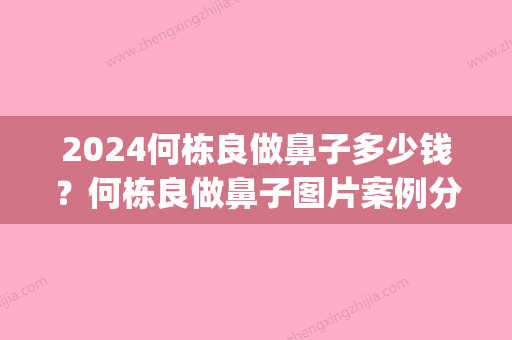 2024何栋良做鼻子多少钱？何栋良做鼻子图片案例分享(韩国栋鼻子做得怎么样)