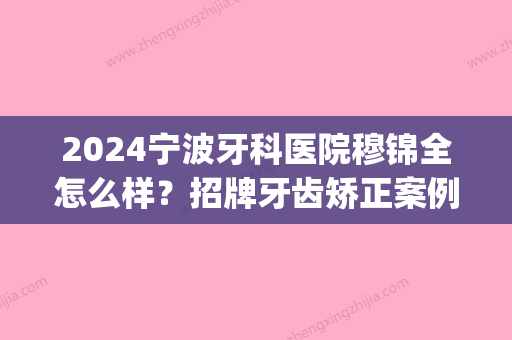 2024宁波牙科医院穆锦全怎么样？招牌牙齿矫正案例+果图展示(宁波牙科穆锦全费用)