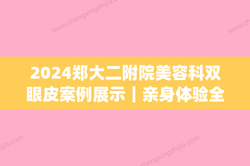 2024郑大二附院美容科双眼皮案例展示｜亲身体验全过程集中一览(郑大二附院王璐割的双眼皮怎么样)