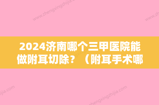 2024济南哪个三甲医院能做附耳切除？（附耳手术哪个医院好）