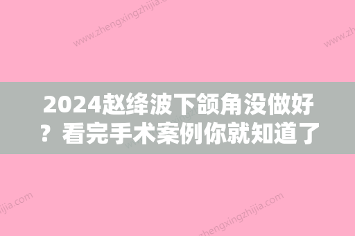 2024赵绛波下颌角没做好？看完手术案例你就知道了!