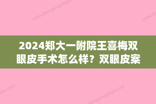 2024郑大一附院王喜梅双眼皮手术怎么样？双眼皮案例(郑大一附院做双眼皮)