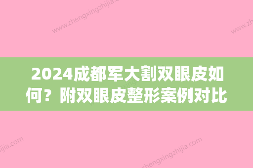 2024成都军大割双眼皮如何？附双眼皮整形案例对比照片(成都做双眼皮手术)