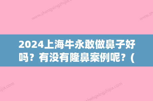 2024上海牛永敢做鼻子好吗？有没有隆鼻案例呢？(牛永敢鼻子做得怎么样)