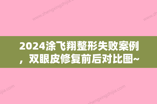 2024涂飞翔整形失败案例，双眼皮修复前后对比图~