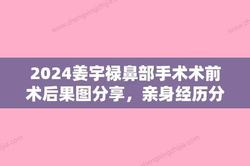 2024姜宇禄鼻部手术术前术后果图分享，亲身经历分享