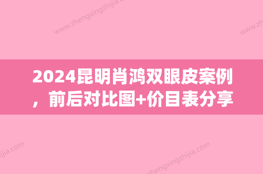 2024昆明肖鸿双眼皮案例，前后对比图+价目表分享~(昆明肖鸿双眼皮预约)